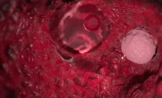 کشف شیوه عجیب پخش شدن سلول های سرطانی