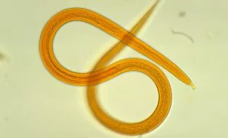 کرم لوله ای