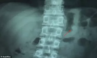 ایرپادهای اپل