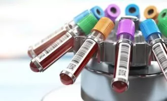 آزمایش خون