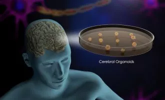 مغز آزمایشگاهی