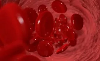 درمان بیماری آلزایمر