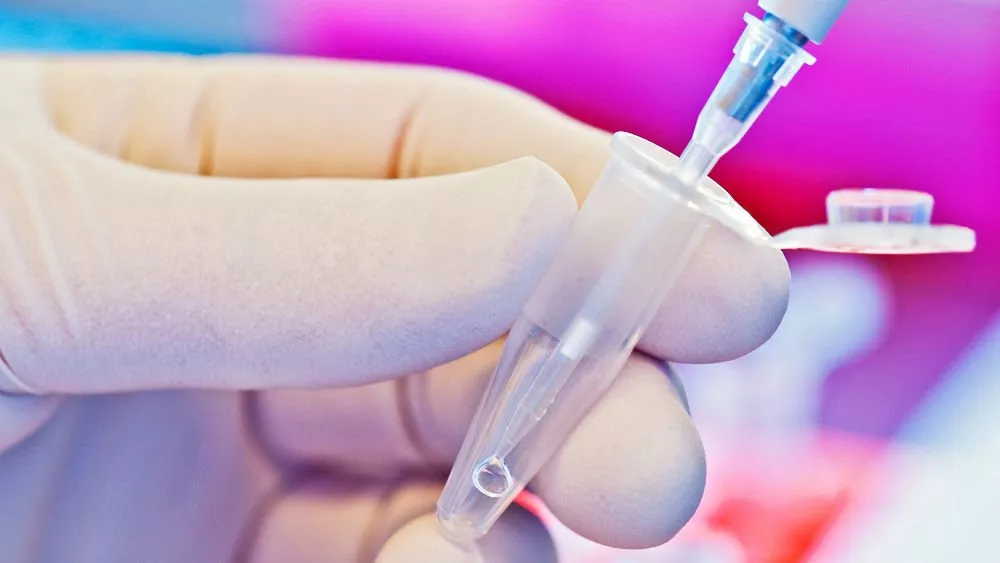 آزمایش DNA