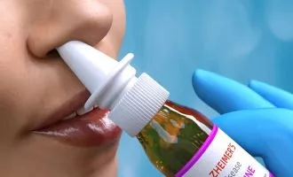 آلزایمر