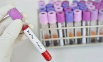 تست آنفلوانزای پرندگان