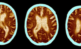 تاثیر شناختی ویروس کرونا بر بدن