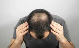 شناسایی پروتئین دخیل در ریزش مو