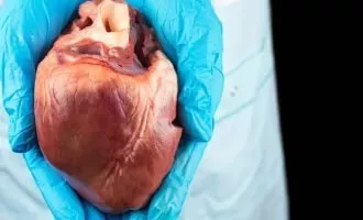 بیمار HIV مثبت