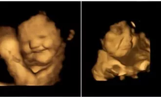 چهره جنین در برابر مزه‌ها