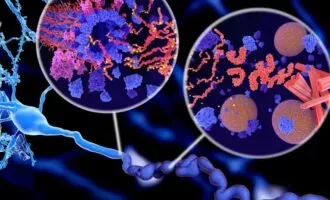 پروتئین تائو آمیلوید