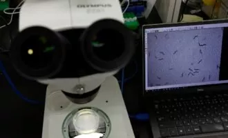 تشخیص سلول‌های سرطانی