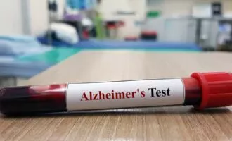 آزمایش آلزایمر