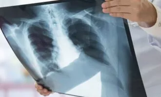 اسکن پرتو ایکس