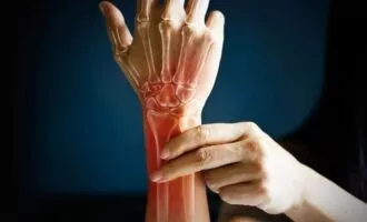 پوکی استخوان