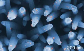 تشخیص سرطان