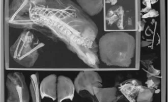 جنین دوقلو داخل مومیایی