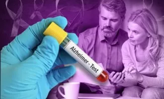 آزمایش خون آلزایمر