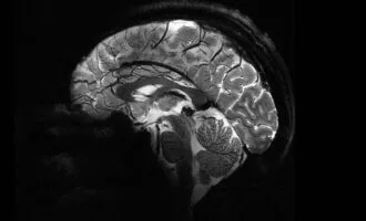 قدرتمندترین MRI جهان