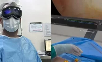 هدست ویژن پرو و جراحی