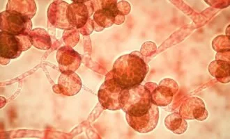 عفونت قارچی