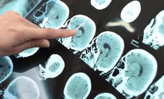 شبکه مغزی بزرگ‌تر در مغز