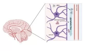 سیستم فاضلاب مغزی