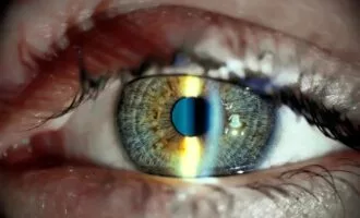 پیوند سلول‌های بنیادی چشم