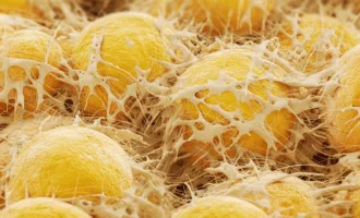 چرا کاهش وزن دشوار است؟ پاسخ در حافظه سلول‌های چربی نهفته است