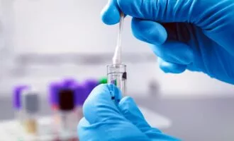 آزمایش تشخیص عفونت