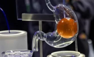 بالون معده جدید برای کاهش وزن