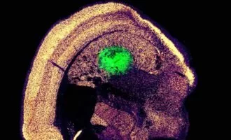 تبدیل مستقیم پوست به سلول‌های عصبی