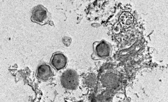 عفونت ویروس غول‌پیکر در جلبک تک‌سلولی فلورنسلا. ویروس‌های غول‌پیکر را می‌توان دید که با کپسیدهای شش‌ضلعی شکل خود — که ماده ژنتیکی‌شان را دربرگرفته‌اند — از درون سلول فلورنسلا خارج می‌شوند.