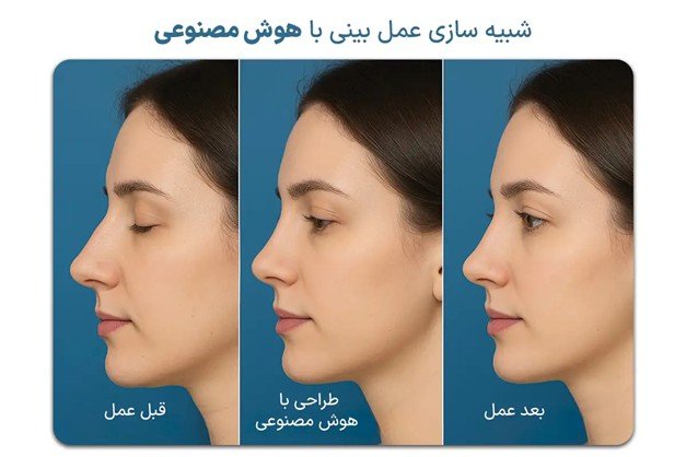 شبیه‌سازی عمل بینی با هوش مصنوعی