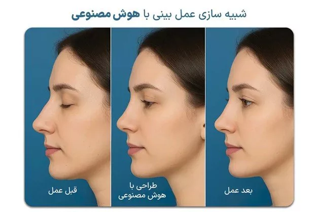 شبیه‌سازی عمل بینی با هوش مصنوعی