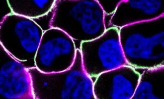 تشخیص سرطان با نور