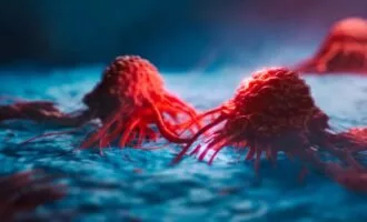 کاهش رشد سلول‌های سرطانی با ورزش