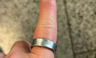 تورم باتری گلکسی رینگ