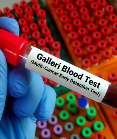 آزمایش خون Galleri می‌تواند بیش از 50 نوع سرطان را در مراحل اولیه تشخیص دهد