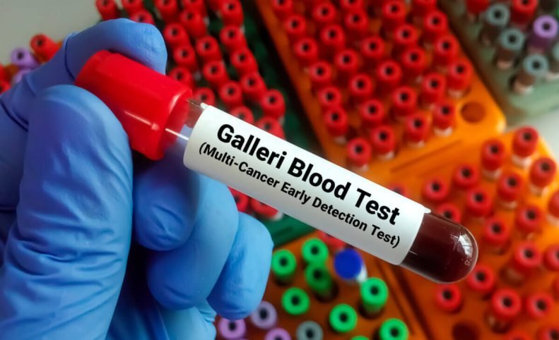 آزمایش خون Galleri می‌تواند بیش از 50 نوع سرطان را در مراحل اولیه تشخیص دهد