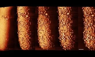 آنتی‌بیوتیک