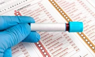 سندرم خستگی مزمن