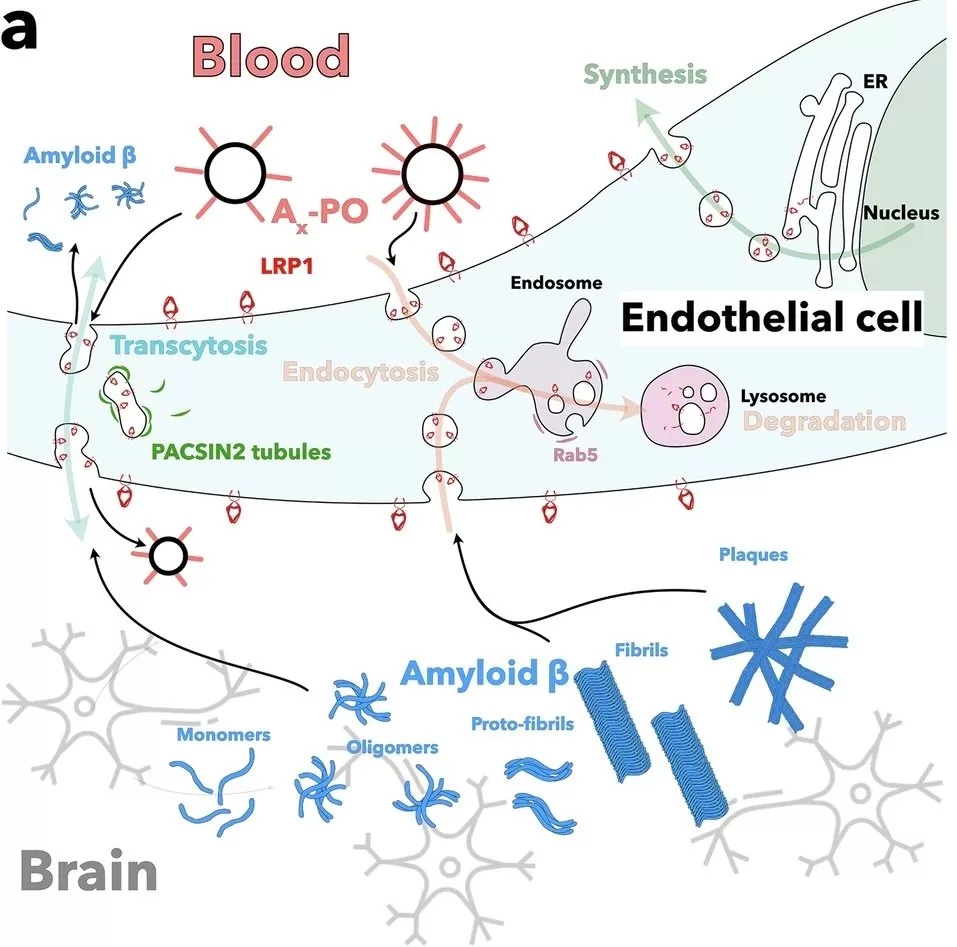 درمان آلزایمر با نانوذرات