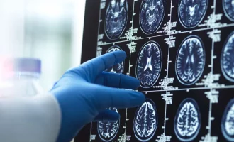 مراحل رشد مغز انسان