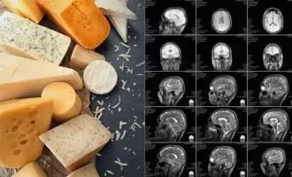ارتباط مصرف پنیر و زوال عقل
