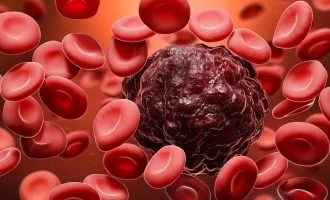 تشخیص سرطان خون با هوش مصنوعی