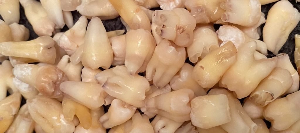 تبدیل سلولهای مغز دندان به نورون