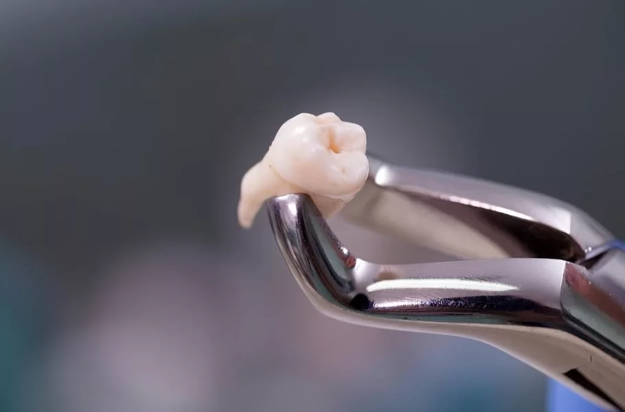 تبدیل سلول‌های مغز دندان به نورون