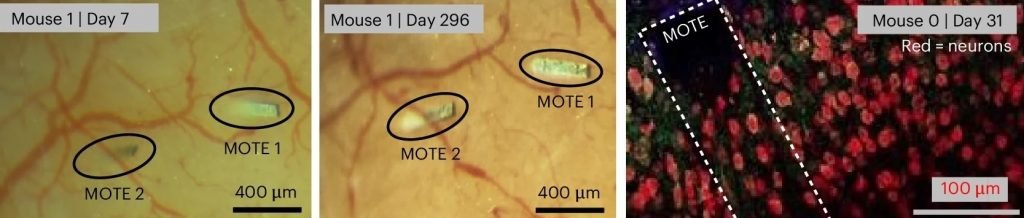 ایمپلنت برای بررسی فعالیتهای مغز