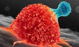 سلول‌های ایمنی و سرطان