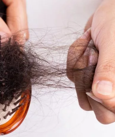 ریزش مو در اثر استرس